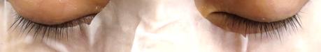 cellula_ii_after1