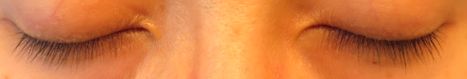 cellula_ii_before2